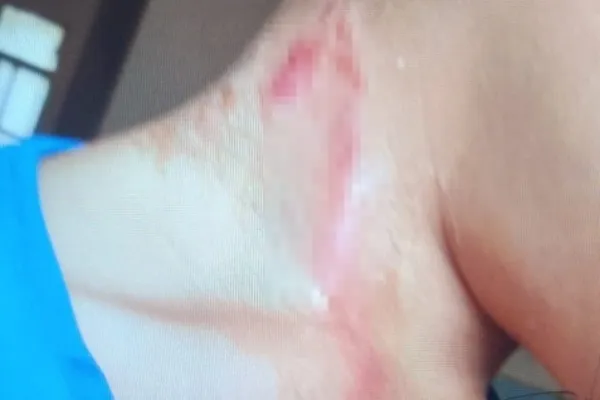 Foto Certa Ferida 2